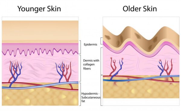 Cosmetic : Original Vit-A Cream 10 g. : Intense Formula - Acne Aging by VITARA - Image 3