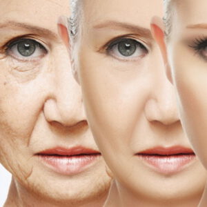 Cosmetic : 30 g. X 2 tubes : Original Vit-A Cream ( Moderate Formula ) by GALDERMA