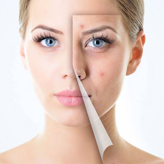 “Get Rid of Wrinkles and Acne with Tretinoin” Your Skincare Solution
