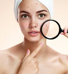 Best Ingredients for Oily Skin and Acne