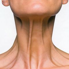 How to Improve Neck Appearance and Tighten Skin. Solutions for Wrinkled, Sagging, and Folded Neck